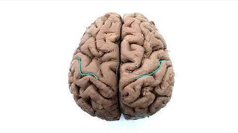 JL Pascual   Neuroanatomy of the Corticobulbar and Corticospinal Tracts Part 1