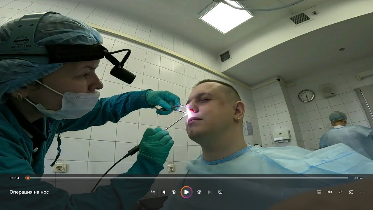 Вопрос операции на нос. Консультация. Боткинская больница. Москва ...