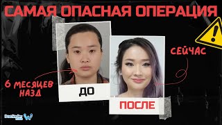 САМАЯ ОПАСНАЯ ОПЕРАЦИЯ! Двухчелюстная операция в Корее.