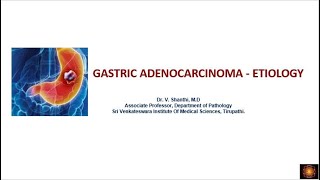 Gastric carcinoma   etiopathogenesis