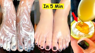 Remove Dark Feet  - पार्लर जैसा Feet Brightening | How I Remove Tan From Hands & Feet