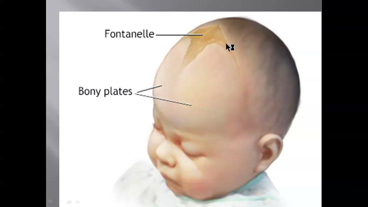 Выбухание родничка. Форма головы у новорожденных. Правильная форма головы у новорожденного. Выбухание большого родничка.
