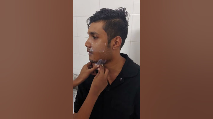wow.. what a transformation after bijaw surgery