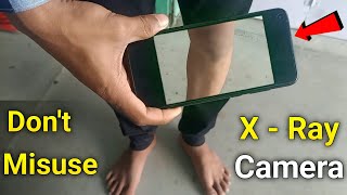 X Ray Camera Body Scanner App Real Or Fake