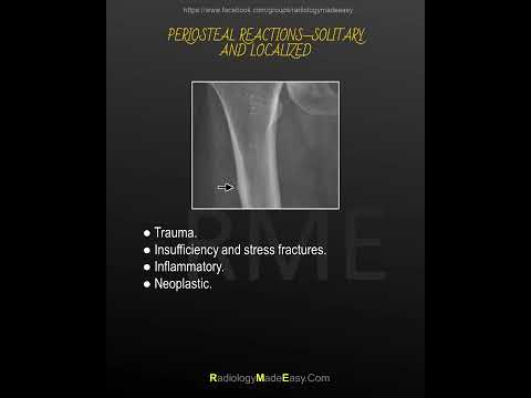 ቪዲዮ: የስፖንጊ አጥንት periosteum አለው?