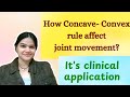 Concave-Convex Rule: Concept, Uses & Applications