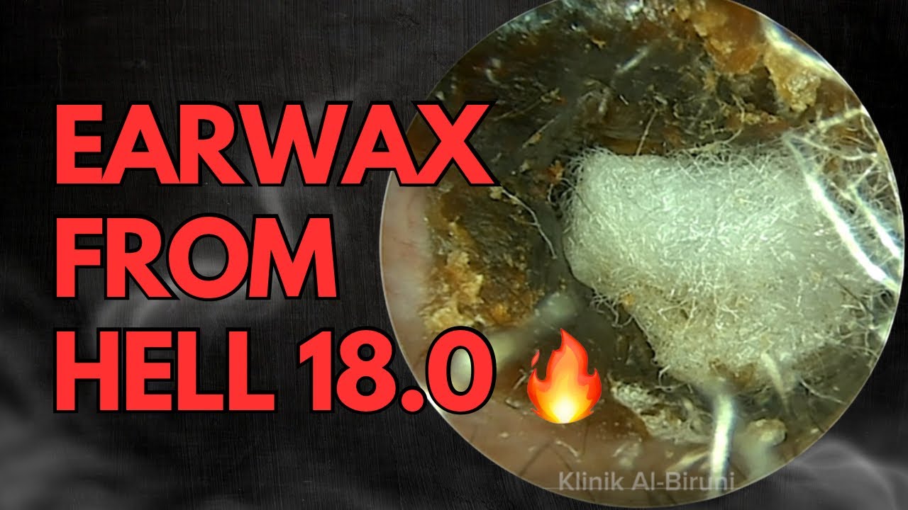 Earwax From Hell 18.0🔥🔥