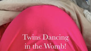 Twins Dancing in the Womb!