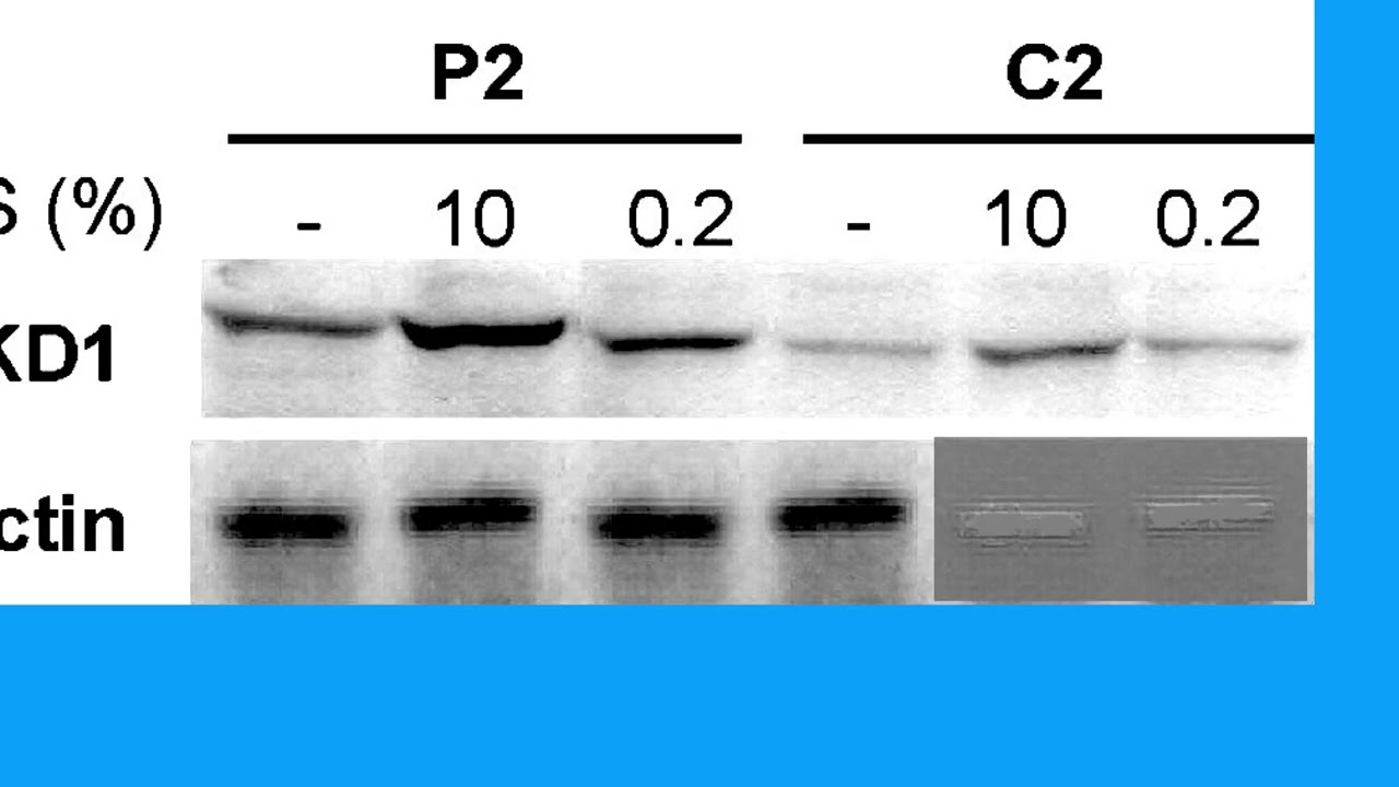 47396C09B036141091BADAC89AD429#1