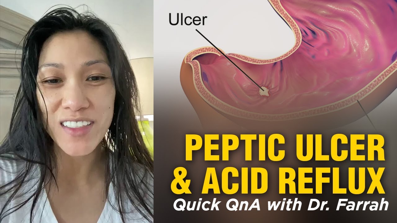 Dr. Farrah on Ulcer Symptoms and the Home Remedy to Manage Pain and Discomfort