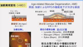 iPS再生医療 プログラム説明 齋藤英彦