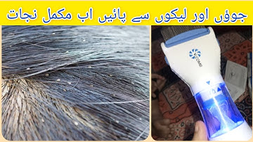 V-Comb Head Lice & Nits Removal Treatment || It Works or Not ❓🤔