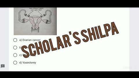 PAS Biology 10+2 13-08-2021 Quiz 2