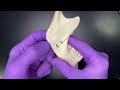 Osso da Manbíbula | Anatomia Mandibular