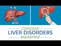 Signs and symptoms of common liver disorders jaundice hepatitis and cirrhosis cure91