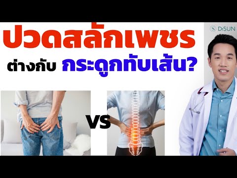 ปวดสลักเพชร ต่างกับ กระดูกทับเส้น ยังไง? คนปวดทุกคนต้องรู้!  /หมอซัน ปวดสลักเพชร อาการ