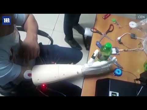Watch the incredible moment that a man moves his new bionic hand using just his MIND