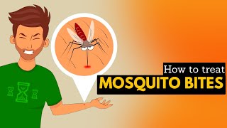 How To Treat Mosquito Bites.