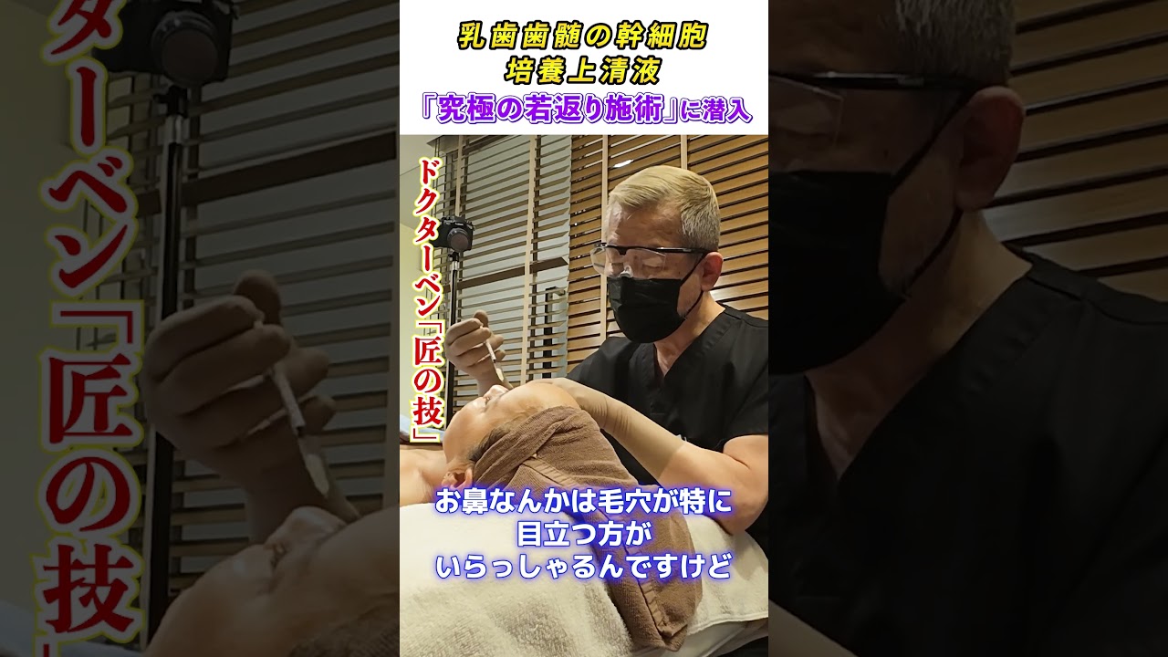 「幹細胞治療」熟練の施術をご覧あれ！#美容 #若返り #幹細胞