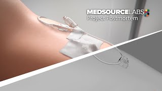 From Concept to Final: Ghost Medicals Creative Medical Animation Process for MedSource Labs