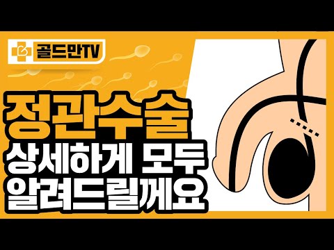 정관수술 받아? 말아?, 정관수술에 대한 오해와 진실은...(ft. 성기능, 정력)