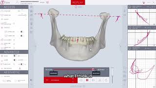 Biofunctional Dynamic Considerations And Simplified Workflows
