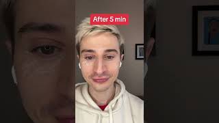 Viral Eye Tightener.