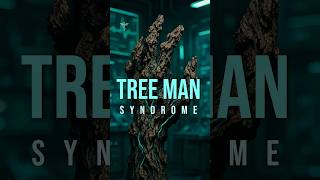 Explained The Man Who Grew Bark