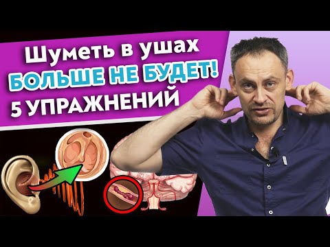 Видео: 5 способов убрать шум в ушах | Упражнения от шума в ушах | Причины тиннитуса