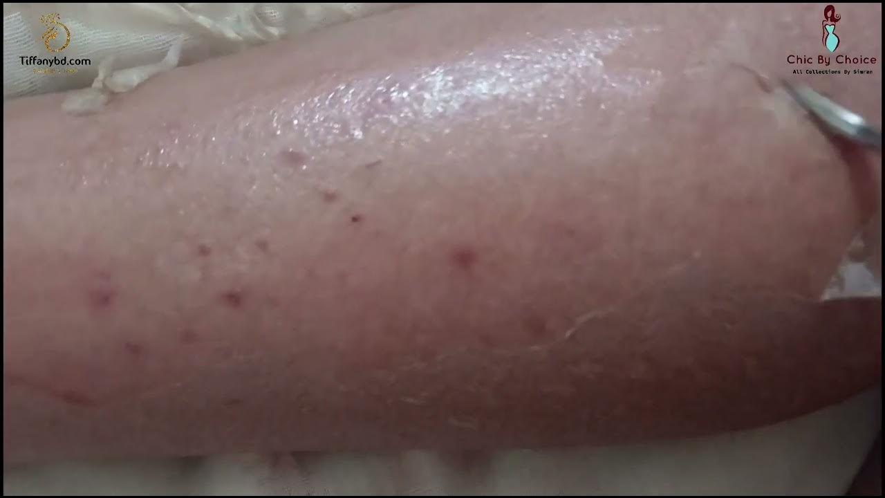leg-peeling-body-whitening-skincare-yellow-peeling-oil-chemical