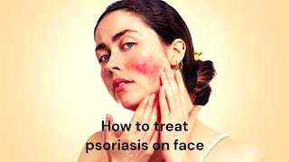 How to Treat Psoriasis on Face