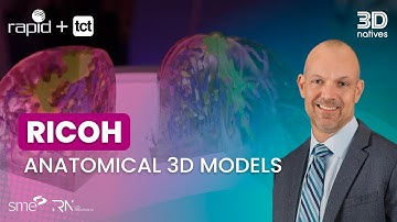 RICOH Shows 3D Printed Breast Cancer Surgical Models at RAPID + TCT 2025 | 3Dnatives