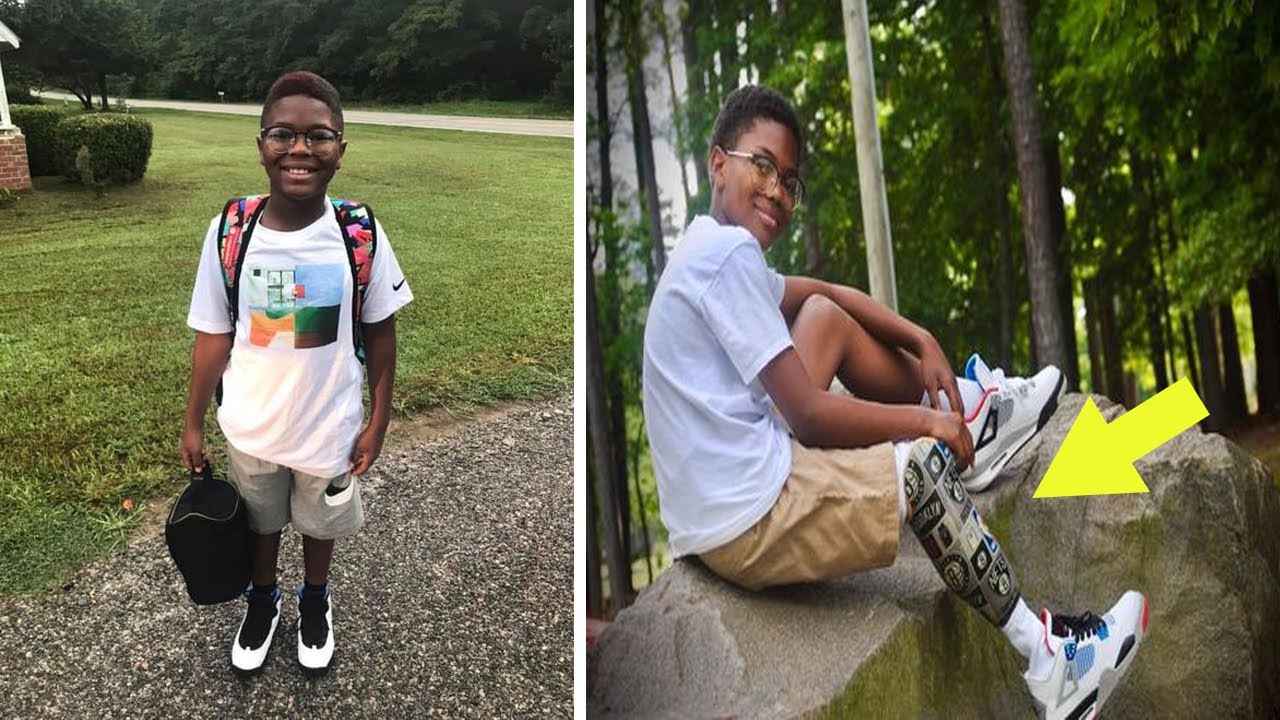 12Year Old Boy Loses Leg On the Way To School For An Incredible Heroic