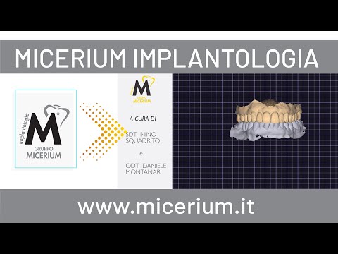 JMA Optic Zebris Micerium-Laboratorio parte 2