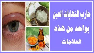 حارب التهابات العين بواححد من هذه العلاجات