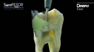 SureFil SDR Flow