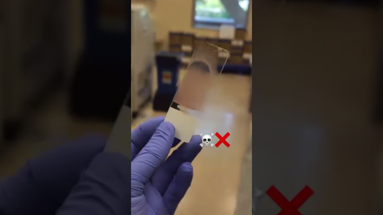 How to make Blood Smear 