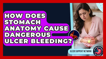 How Does Stomach Anatomy Cause Dangerous Ulcer Bleeding? - Ulcer Support Network