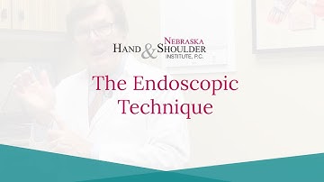 Carpal Tunnel Surgery: The Endoscopic Technique