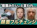 顔の良さがホストでの売上に直結する現実。。。覚悟を決めて全顔整形した結果どうなる?