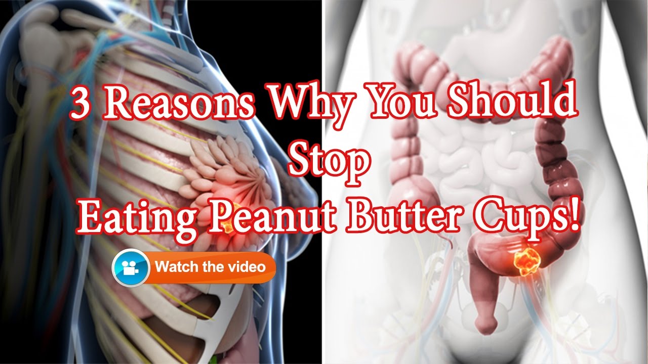 ☑️3 Reasons Why You Should Stop Eating Peanut Butter Cups! YouTube