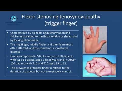 Professor Ali S M Jawad - APPS UK International Medical Conference 2017 - London
