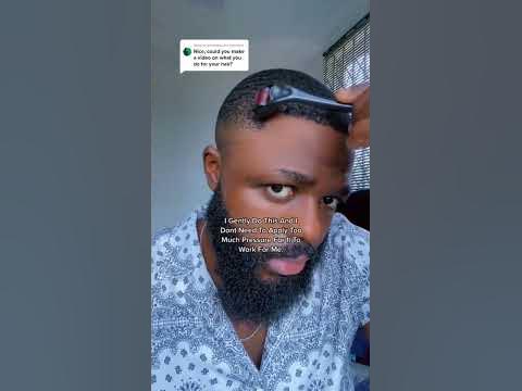 How I Use Derma Roller And Minoxidil To Prevent A Receding Hairline