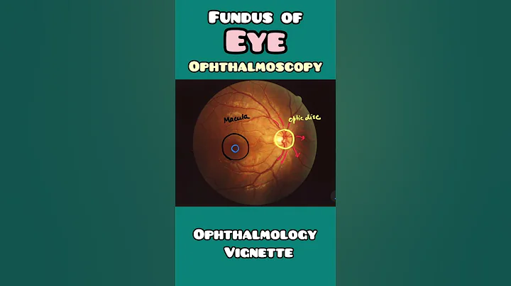Fundus of an EYE explained simply in less than 60 seconds !  USMLE, NEET PG,  NCLEX