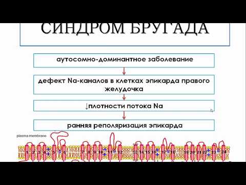Video: Brugada Syndrom: Co To Je, Příčiny, Léčení A Další