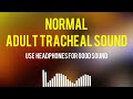 Normal adult  tracheal sound