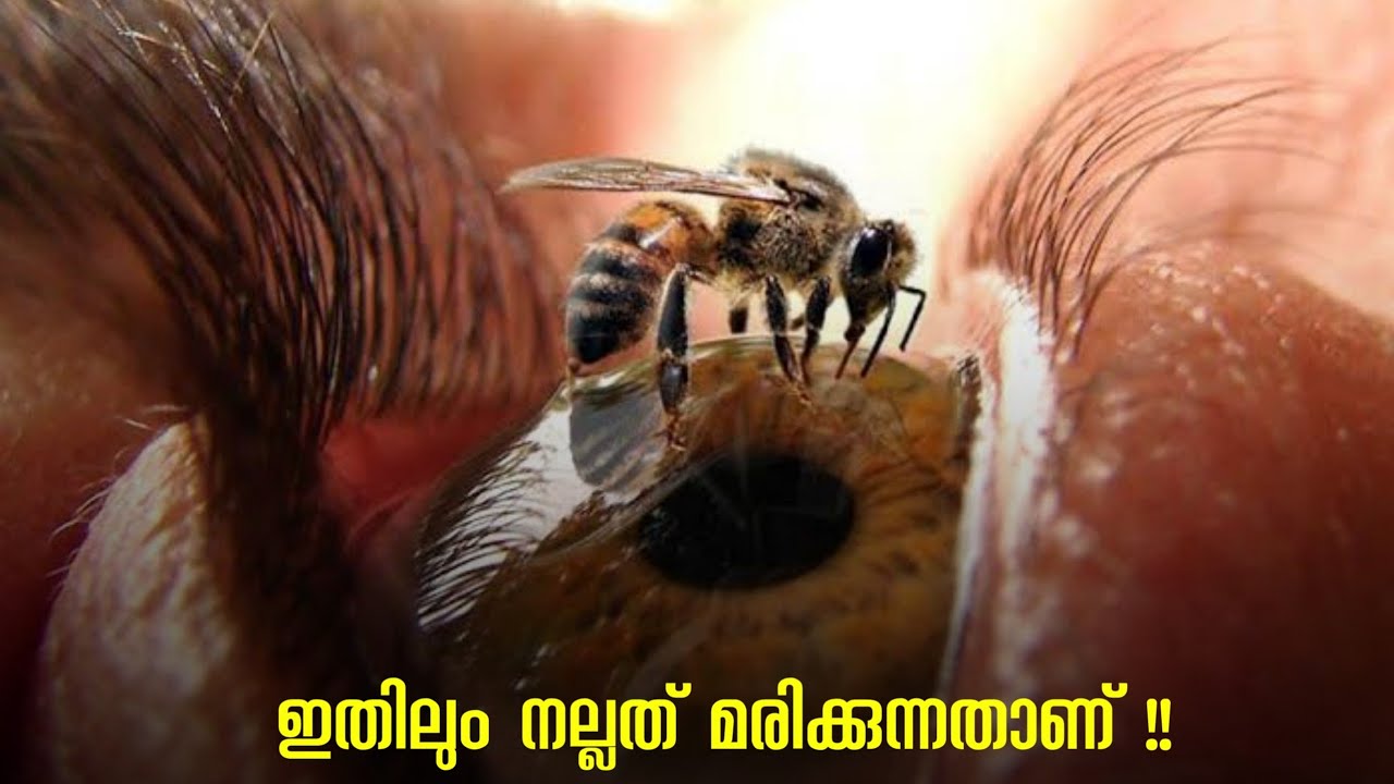 ഒര മനഷയന അനഭവകകവനന ഏററവ വലയ വദന Most Painful Things A Human Can Experience