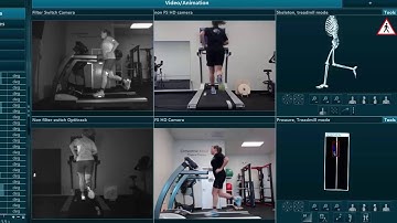 Running Form Can Be Improved: Impact Peak and Loading Comparison