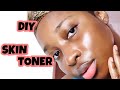DIY SKIN TONER - Lemon & Aloe Vera (stretch mark remover, acne cure, clear & glowing skin!