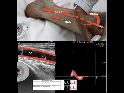 Ультразвуковое исследование  аорты, артерий подвздошных нижних  конечностей